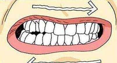 成人修磨牙过程视频播放,视频解析全过程
